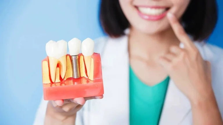 dis-implantı-alpdent