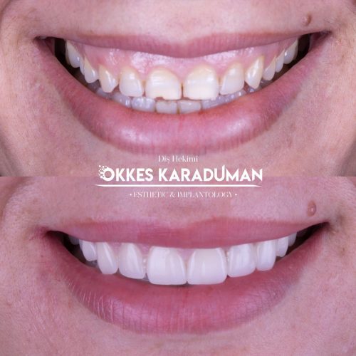 dt.karaduman_1681896288_3084292070339405704_1183031340