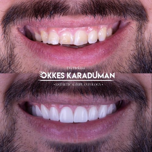 dt.karaduman_1681978512_3084981817072231551_1183031340