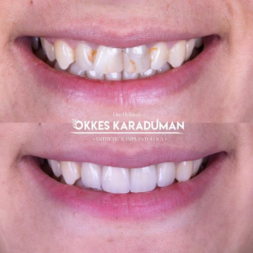 dt.karaduman_1682097294_3085978235123580881_1183031340