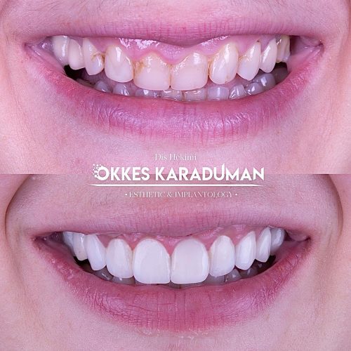 dt.karaduman_1682236890_3087149251615223454_1183031340