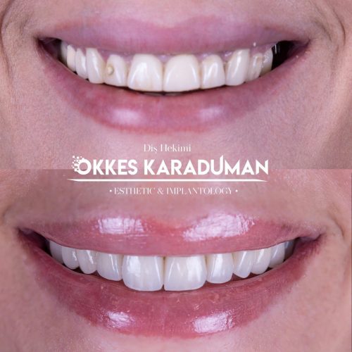 dt.karaduman_1682324029_3087880220982900278_1183031340