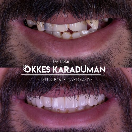 dt.karaduman_1688396502_3138819817182694859_1183031340