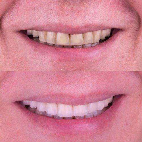 dt.karaduman_1688732772_3141640658899567846_1183031340