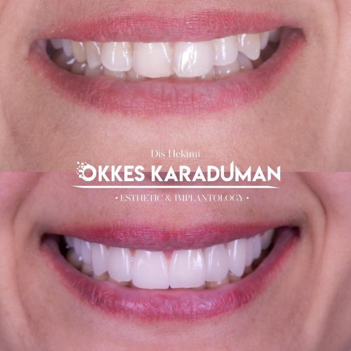 dt.karaduman_1693219633_3179279176777752934_1183031340