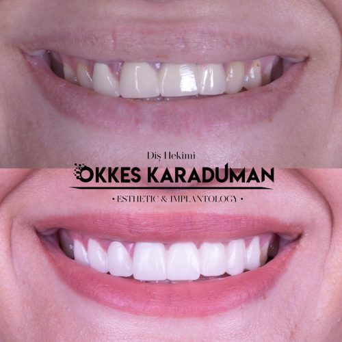 dt.karaduman_1693508354_3181701144613387704_1183031340