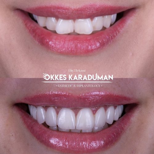 dt.karaduman_1694448162_3189584819564604950_1183031340