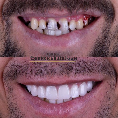 dt.karaduman_1696280891_3204958865143705378_1183031340