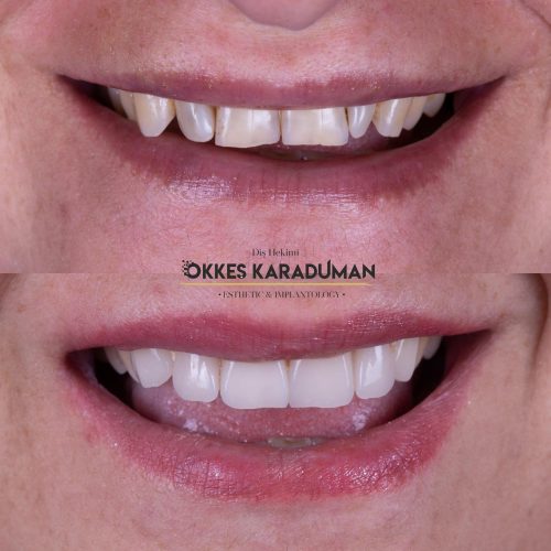 dt.karaduman_1696353424_3205567315947073131_1183031340