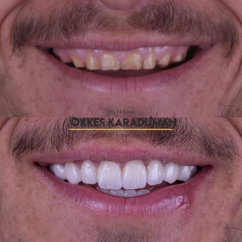 dt.karaduman_1696569823_3207382609233470696_1183031340