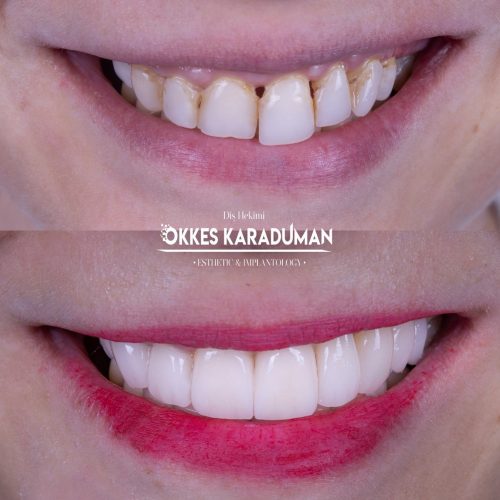 dt.karaduman_1696839345_3209643519192953177_1183031340