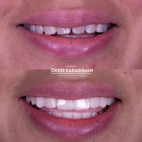 dt.karaduman_1697091110_3211755476297611140_1183031340