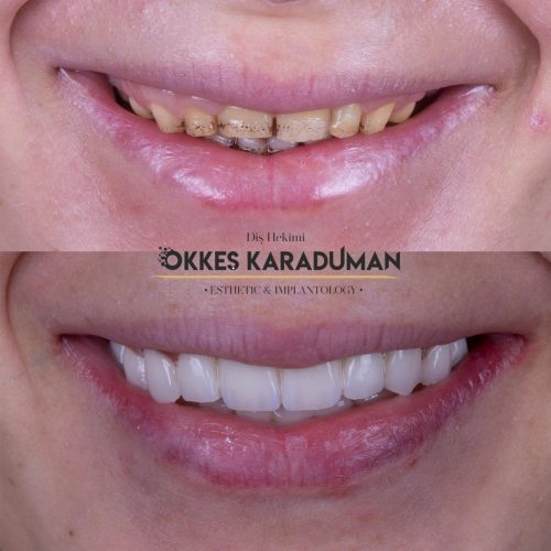 dt.karaduman_1697215720_3212800783030653896_1183031340