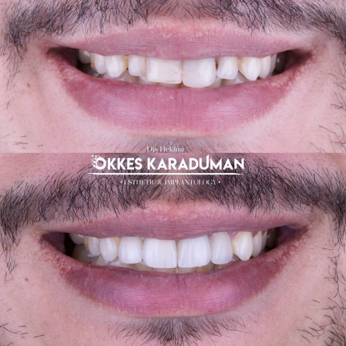 dt.karaduman_1698393605_3222681599588137933_1183031340