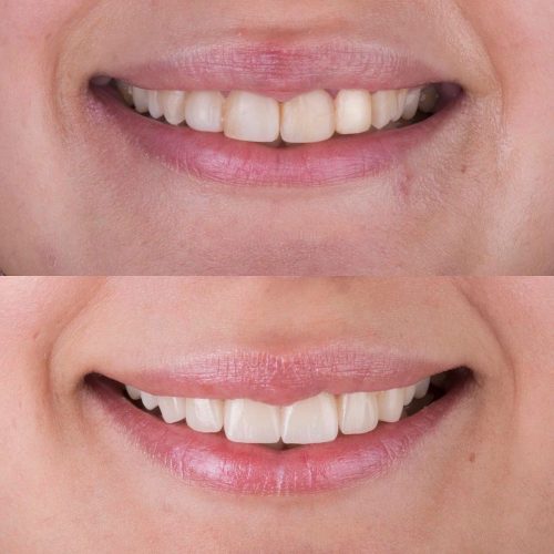 dt.karaduman_1699895048_3235276614940132493_1183031340