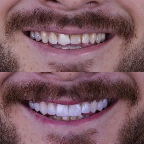 dt.karaduman_1703525964_3265734943998944371_1183031340