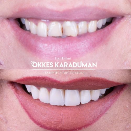 dt.karaduman_1706092543_3287264970221494258_1183031340