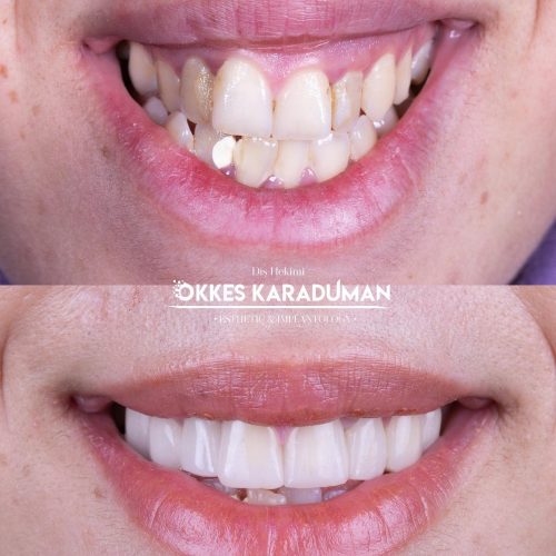 dt.karaduman_1706869314_3293780999147685440_1183031340