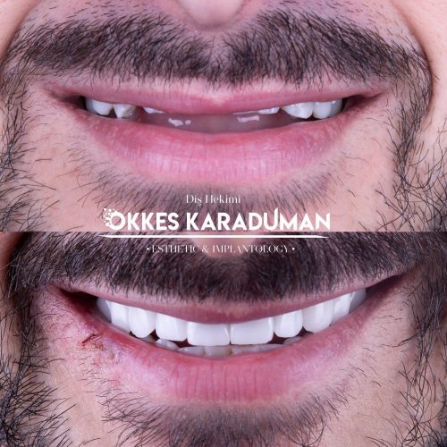 dt.karaduman_1707912603_3302532742320751464_1183031340