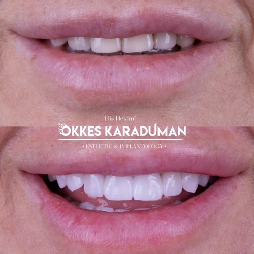 dt.karaduman_1708933788_3311099059281905688_1183031340