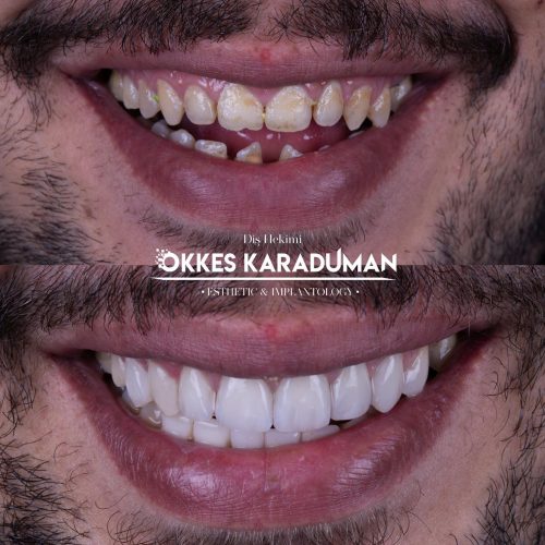 dt.karaduman_1710259948_3322223697646901524_1183031340