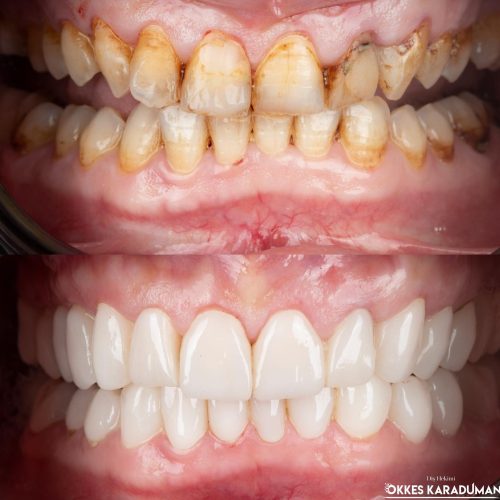 dt.karaduman_1711473552_3332404144989274174_1183031340