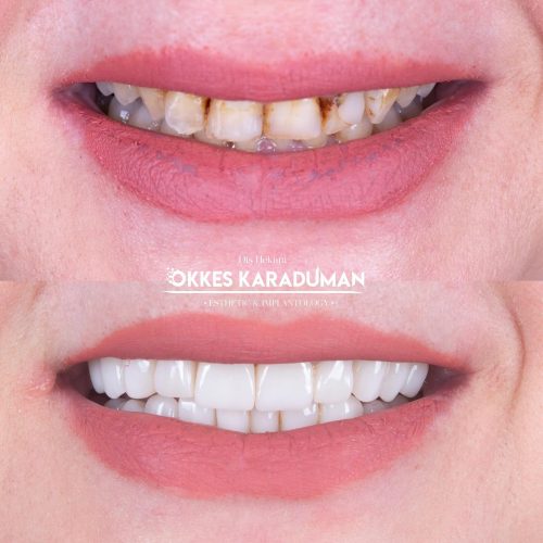 dt.karaduman_1712307281_3339397975345671827_1183031340