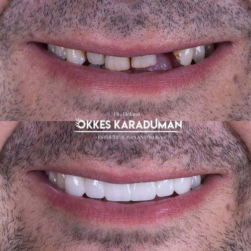 dt.karaduman_1712488624_3340919185544004967_1183031340