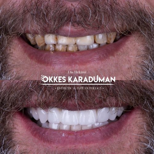 dt.karaduman_1714324607_3356320526797842712_1183031340