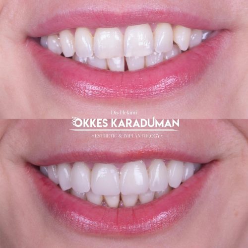 dt.karaduman_1715153324_3363272309684304776_1183031340