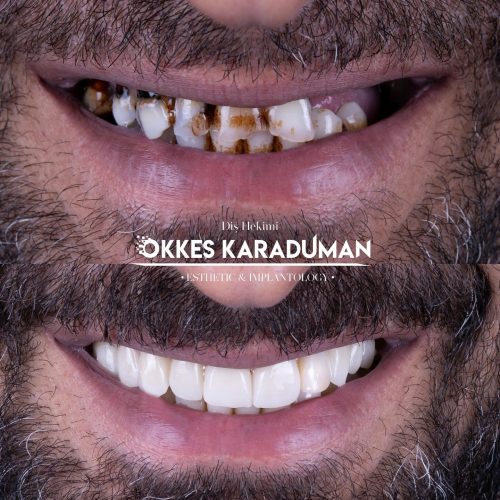 dt.karaduman_1716624979_3375617450054859506_1183031340