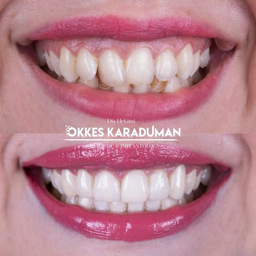 dt.karaduman_1718030815_3387410457775159638_1183031340