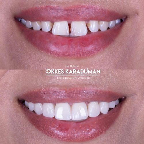 dt.karaduman_1726899036_3461802487569256372_1183031340