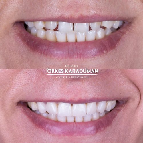 dt.karaduman_1729021200_3479604487732293600_1183031340