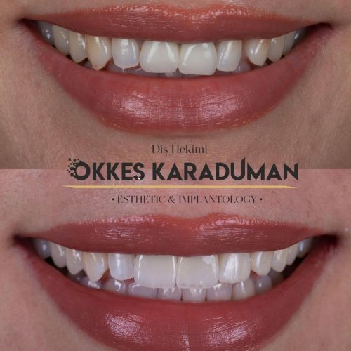 dt.karaduman_1731066917_3496765201001222513_1183031340