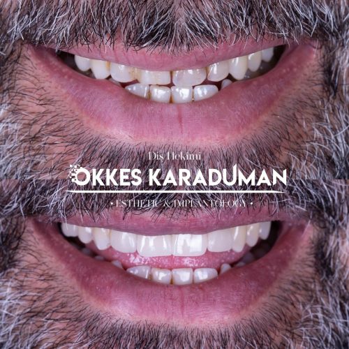 dt.karaduman_1731931893_3504021152548965388_1183031340