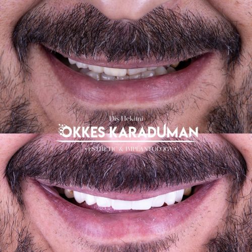 dt.karaduman_1735467341_3533678636284712145_1183031340